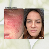 Clarity Bioactive Clearing Serum